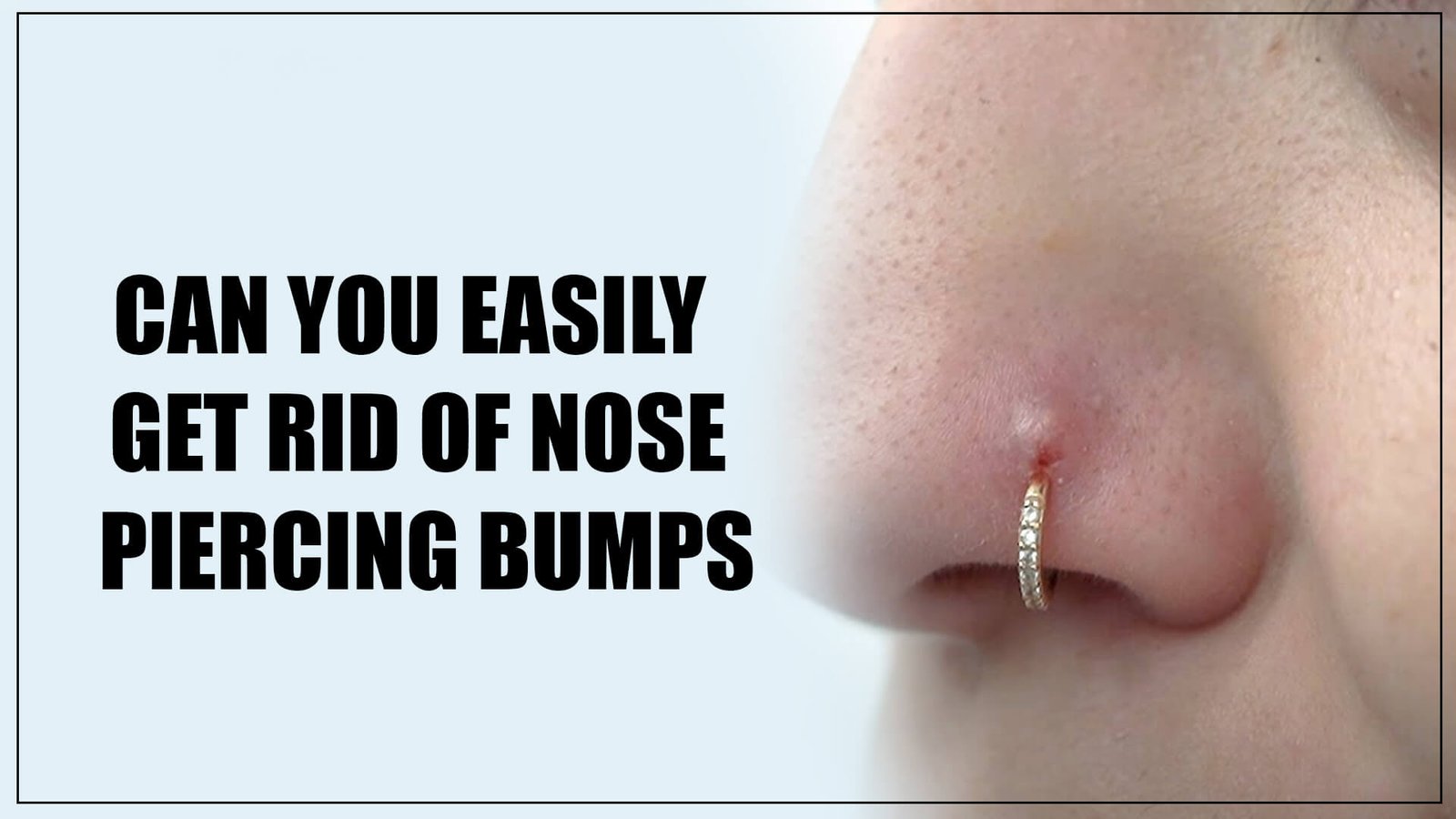 nose bumps