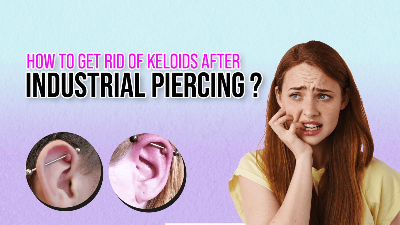How to Get Rid of Keloids After Industrial Piercing