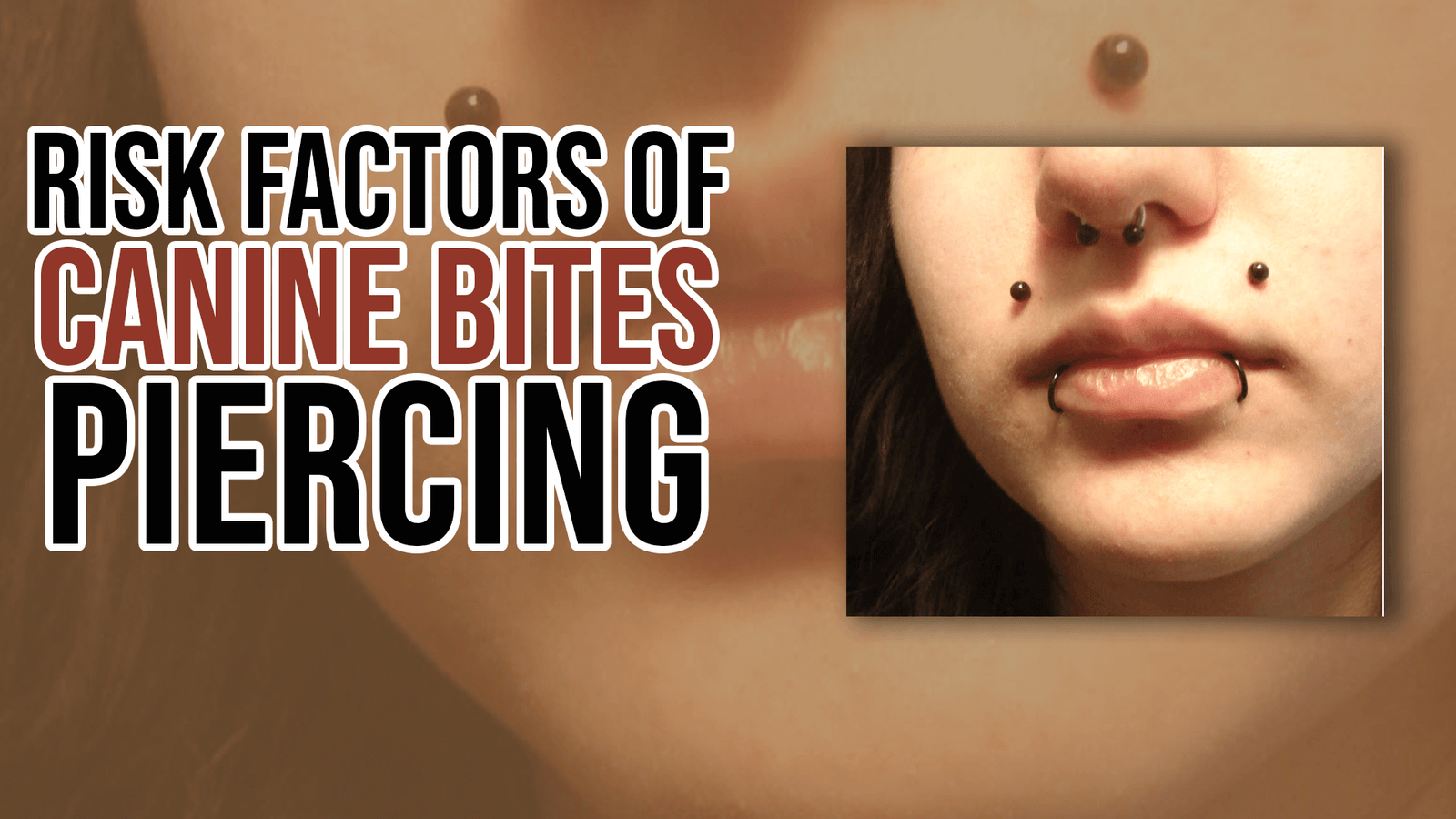 Risk Factors of Canine Bites Piercing